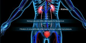 Hemodialysis and Peritoneal dialysis 