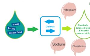 Dialysate 