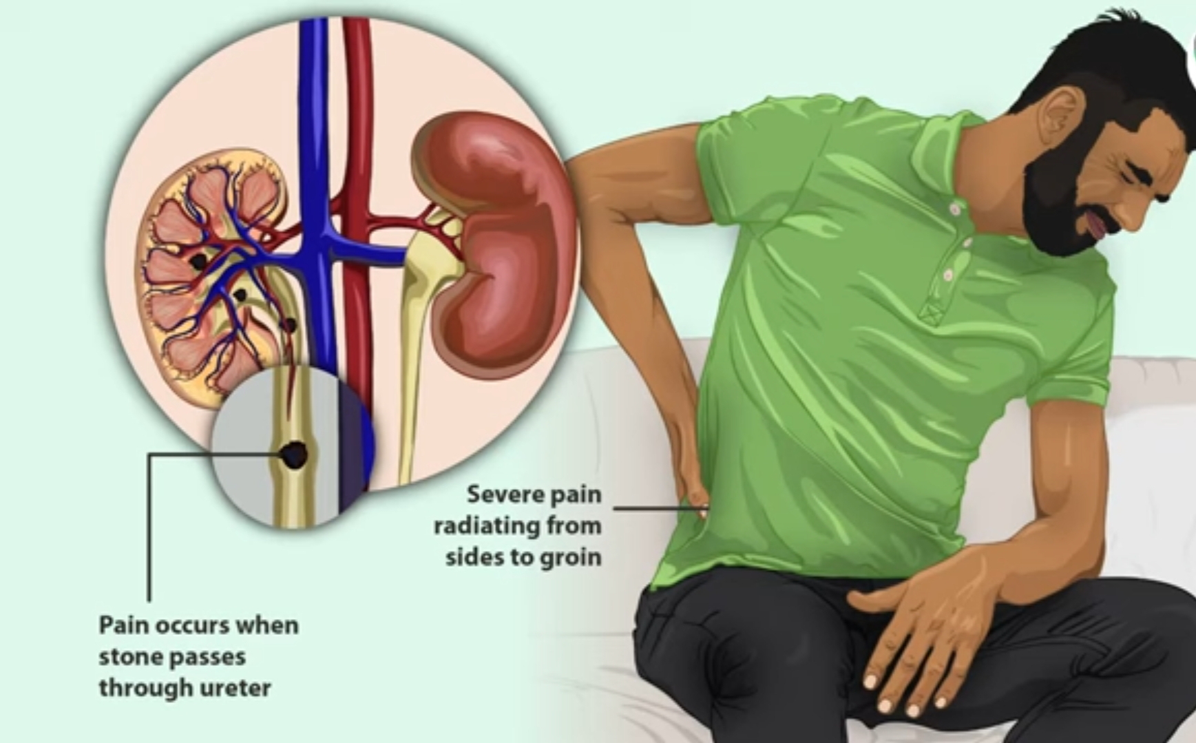 Dialysis